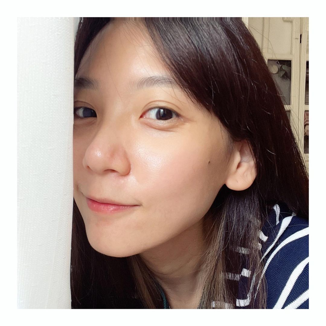 【杏仁酸煥膚】星和診所/板橋店-臉部肌膚超有光澤&平滑，好心情也瞬間UP UP-蜻蜓